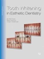 Tooth Whitening in Esthetic Dentistry