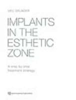 Implants in the Esthetic Zone