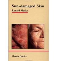 Sun-Damaged Skin
