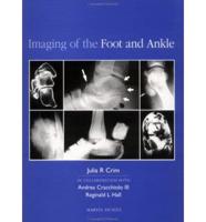 Imaging of the Foot and Ankle