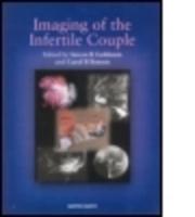 Imaging of the Infertile Couple