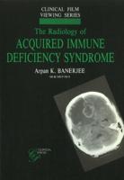 The Radiology of Acquired Immune Deficiency Syndrome