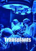 Truth About Transplants