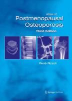 Atlas of Postmenopausal Osteoporosis : Third Edition