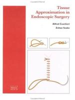 Tissue Approximation in Endoscopic Surgery