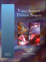 Video-Assisted Thoracic Surgery