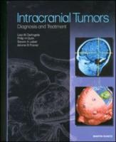 Intracranial Tumors