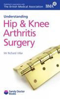 Understanding Hip and Knee Arthritis Surgery