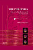 The Epilepsies