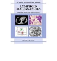 Lymphoid Malignancies