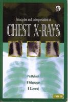 Principles and Interpretation of Chest X-Rays