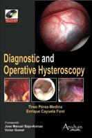 Diagnostic and Operative Hysteroscopy