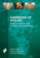 Handbook of Vitiligo