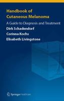 Handbook of Cutaneous Melanoma : A Guide to Diagnosis and Treatment