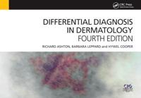 Differential Diagnosis in Dermatology