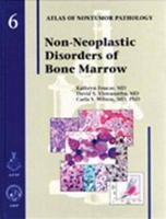 Non-Neoplastic Diseases of Bone Marrow