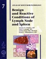 Benign and Reactive Conditions of Lymph Node and Spleen
