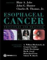 Esophageal Cancer