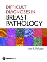Difficult Diagnoses in Breast Pathology