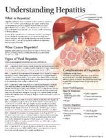 Understanding Hepatitis Model