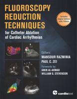 Fluoroscopy Reduction Techniques for Catheter Ablation of Cardiac Arrhythmias