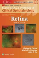 Retina