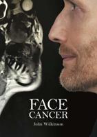 Face Cancer