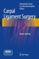 Carpal Ligament Surgery : Before Arthritis