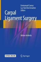 Carpal Ligament Surgery : Before Arthritis