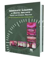 Immediate Loading of Dental Implants