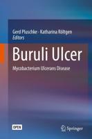 Buruli Ulcer : Mycobacterium Ulcerans Disease