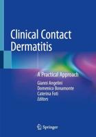 Clinical Contact Dermatitis : A Practical Approach