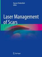 Laser Management of Scars