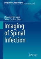 Imaging of Spinal Infection. Diagnostic Imaging