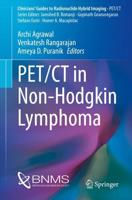 PET/CT in Non-Hodgkin Lymphoma. PET/CT