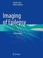 Imaging of Epilepsy