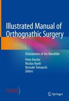 Illustrated Manual of Orthognathic Surgery