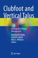 Clubfoot and Vertical Talus