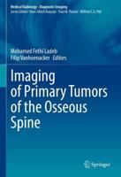 Imaging of Primary Tumors of the Osseous Spine. Diagnostic Imaging