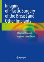 Imaging of Plastic Surgery of the Breast and Other Implants