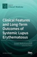 Clinical Features and Long-Term Outcomes of Systemic Lupus Erythematosus