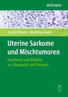 Uterine Sarkome Und Mischtumoren