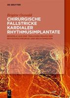 Chirurgische Fallstricke Kardialer Rhythmusimplantate