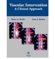 Vascular Intervention