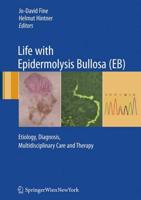 Life with Epidermolysis Bullosa (EB): Etiology, Diagnosis, Multidisciplinary Care and Therapy