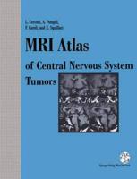 MRI Atlas of Central Nervous System Tumors