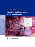 Fallstricke Und Fehlerquellen in Der Dermatologie