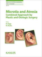 Microtia and Atresia