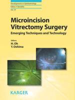Microincision Vitrectomy Surgery