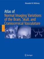 Atlas of Normal Imaging Variations of the Brain, Skull, and Craniocervical Vasculature